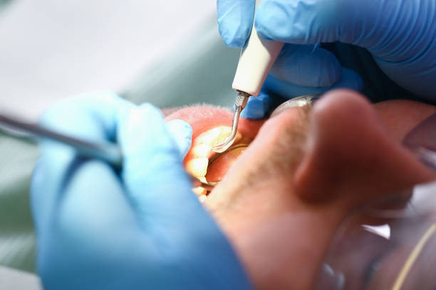 Best Pediatric Emergency Dentist in Farmington, UT