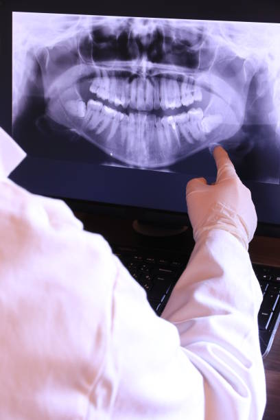 Best Emergency Wisdom Teeth Removal in Farmington, UT